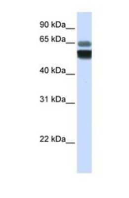 Western Blot: SMPD1 Antibody [NBP1-69267]