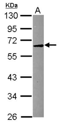 Western Blot: SMPD1 Antibody [NBP2-20426]