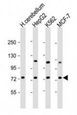 Western Blot: SMPD1 Antibody [NBP2-22365]