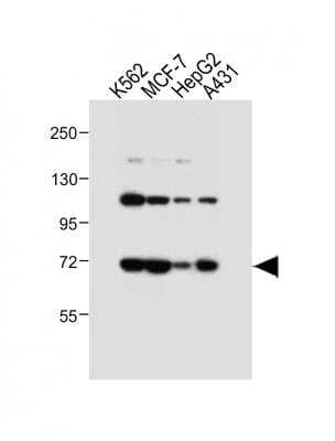 Western Blot: SMPD1 Antibody [NBP2-22365]