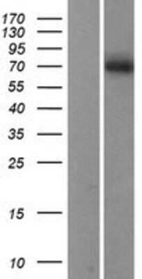 Western Blot: SMPD1 Overexpression Lysate [NBL1-16250]