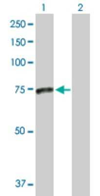 Western Blot: SMPD3/NSMase2 Antibody [H00055512-D01P]