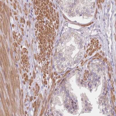 Immunohistochemistry-Paraffin: SMPD4 Antibody [NBP2-33567]