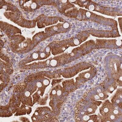 Immunohistochemistry-Paraffin: SMPD4 Antibody [NBP2-33567]