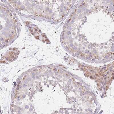 Immunohistochemistry-Paraffin: SMPD4 Antibody [NBP2-33567]