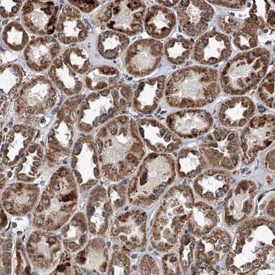 Immunohistochemistry-Paraffin: SMPDL3A Antibody [NBP1-88862]