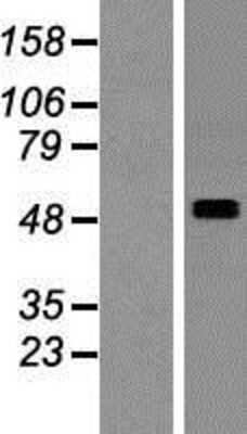 Western Blot: SMPDL3A Overexpression Lysate [NBP2-07590]