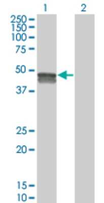 Western Blot: SMPDL3B Antibody (5E12) [H00027293-M01]