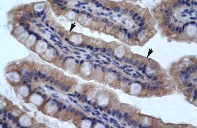 Immunohistochemistry: SMPDL3B Antibody [NBP1-57912]