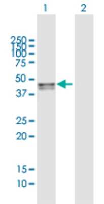 Western Blot: SMPDL3B Antibody [H00027293-B01P]