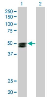 Western Blot: SMPDL3B Antibody [H00027293-D01P]