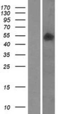 Western Blot: SMPDL3B Overexpression Lysate [NBP2-09865]