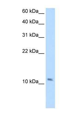 Western Blot: SMPX Antibody [NBP1-53165]