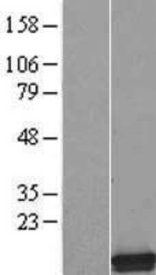 Western Blot: SMPX Overexpression Lysate [NBL1-16253]