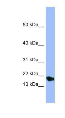 Western Blot: SMR3A Antibody [NBP1-58000]