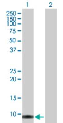 Western Blot: SMR3B Antibody [H00010879-B01P]