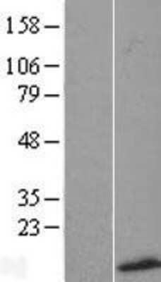 Western Blot: SMR3B Overexpression Lysate [NBL1-16255]