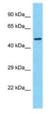 Western Blot: SMTNL1 Antibody [NBP3-09517]