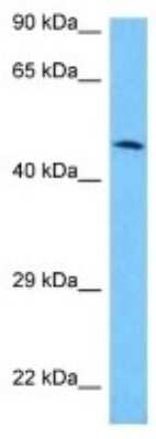 Western Blot: SMTNL2 Antibody [NBP3-10188]