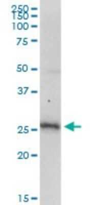 Western Blot: SMUG1 Antibody (4D5) [H00023583-M07]