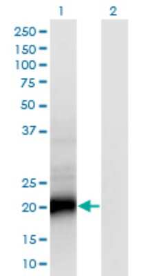 Western Blot: SMUG1 Antibody (4D5) [H00023583-M07]