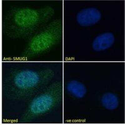 Immunocytochemistry/ Immunofluorescence: SMUG1 Antibody [NB100-1414]