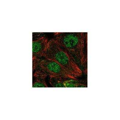 Immunocytochemistry/ Immunofluorescence: SMUG1 Antibody [NBP3-17933]