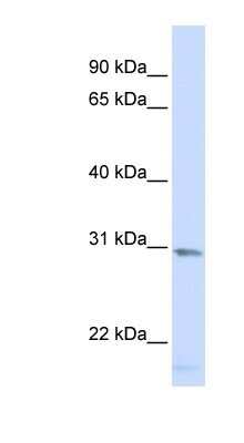 Western Blot: SMUG1 Antibody [NBP1-52981]