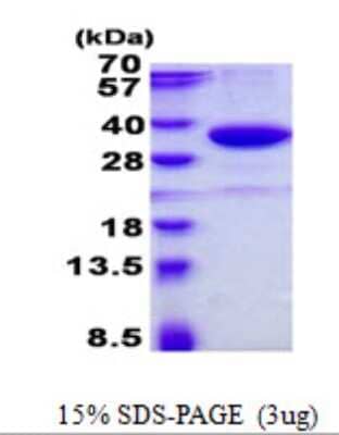 SDS-PAGE: Recombinant Human SMUG1 His Protein [NBP2-22806]