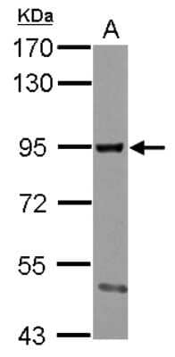 Western Blot: SMURF2 Antibody [NBP2-20427]