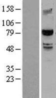 Western Blot: SMURF2 Overexpression Lysate [NBL1-16260]