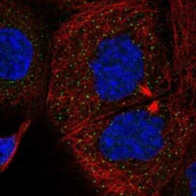 Immunocytochemistry/ Immunofluorescence: SMURF1 Antibody [NBP3-17934]