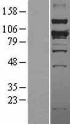 Western Blot: SMURF1 Overexpression Lysate [NBL1-16259]