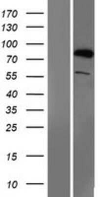 Western Blot: SMURF1 Overexpression Lysate [NBP2-09895]