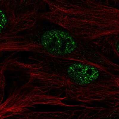 Immunocytochemistry/ Immunofluorescence: SMURF2 Antibody [NBP2-57554]