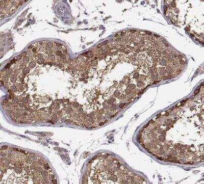 Immunohistochemistry-Paraffin: SMURF2 Antibody [NBP2-57554]