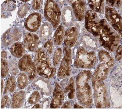 Immunohistochemistry-Paraffin: SMURF2 Antibody [NBP2-57554]