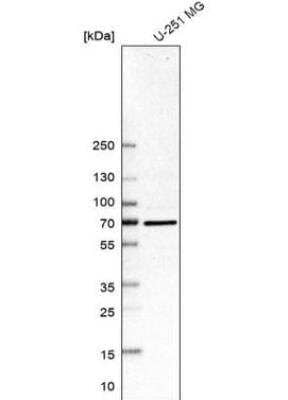 Western Blot: SMURF2 Antibody [NBP2-57554]