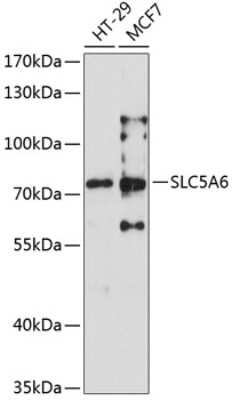 Western Blot: SMVT/SLC5A6 AntibodyAzide and BSA Free [NBP2-94016]