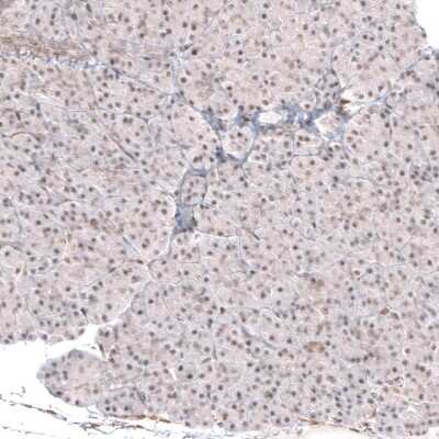 Immunohistochemistry-Paraffin: SMYD2 Antibody [NBP1-83186]