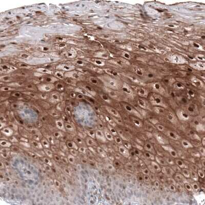 Immunohistochemistry-Paraffin: SMYD2 Antibody [NBP1-83186]