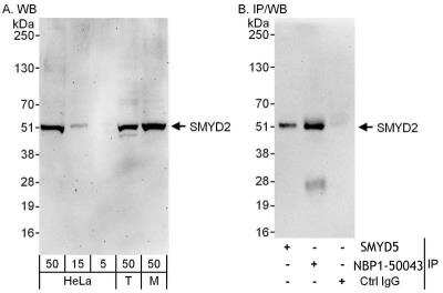 Immunoprecipitation: SMYD2 Antibody [NBP1-50043]