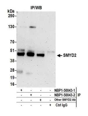 Immunoprecipitation: SMYD2 Antibody [NBP1-50043]