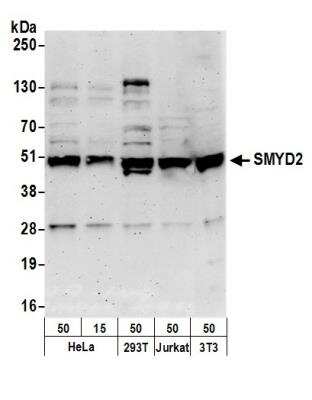 Western Blot: SMYD2 Antibody [NBP1-50043]