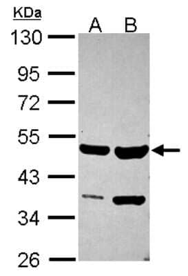 Western Blot: SMYD2 Antibody [NBP2-20429]