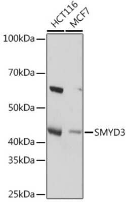 Western Blot: SMYD3 Antibody (2P8Z2) [NBP3-16102]