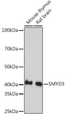 Western Blot: SMYD3 Antibody (2P8Z2) [NBP3-16102]
