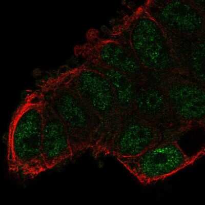 Immunocytochemistry/ Immunofluorescence: SMYD3 Antibody [NBP2-58364]