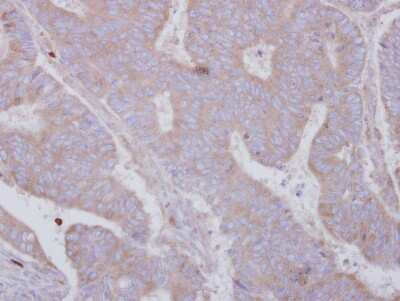 Immunohistochemistry-Paraffin: SMYD3 Antibody [NBP2-20432]