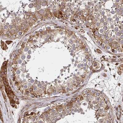 Immunohistochemistry-Paraffin: SMYD3 Antibody [NBP2-55477]